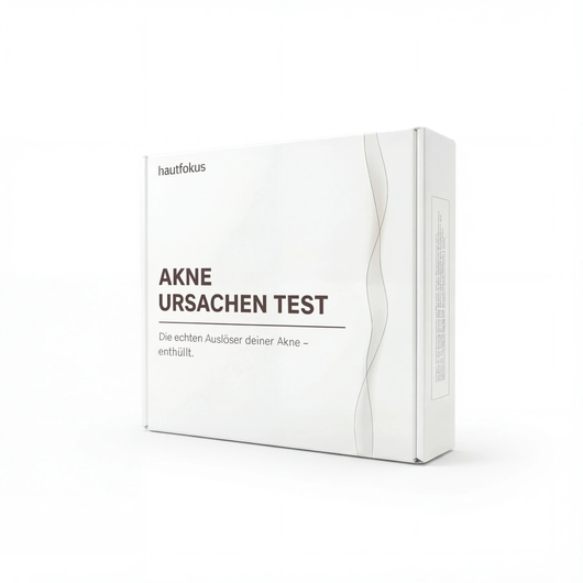 Akne Ursachen Test