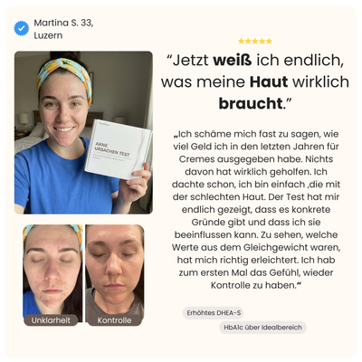 Akne Ursachen Test