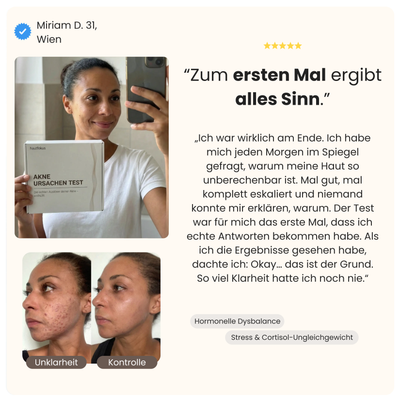 Akne Ursachen Test