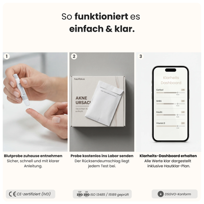 Akne Ursachen Test
