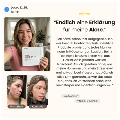 Akne Ursachen Test