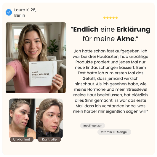 Akne Ursachen Test
